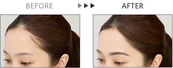 Also apply on the hairline to create a small face effect